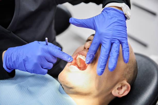 Best Emergency Dental Care for Broken or Chipped Teeth in Brookhaven, PA